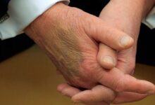 Photo of White House explains bruise on Trump’s hand seen during Macron meeting