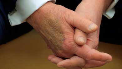 Photo of White House explains bruise on Trump’s hand seen during Macron meeting